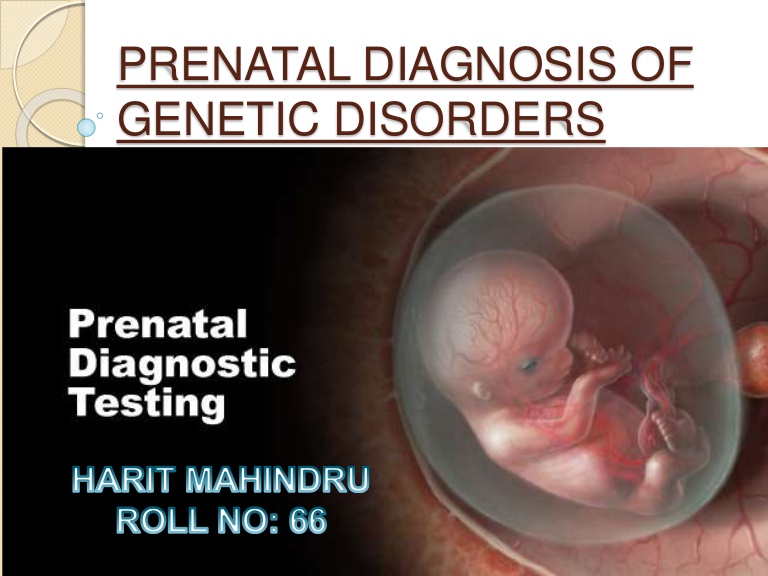 ژنتیک و تشخیص قبل از تولد