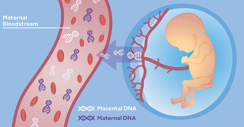 غربالگری سلامت جنین از طریق(Cell Free DNA)